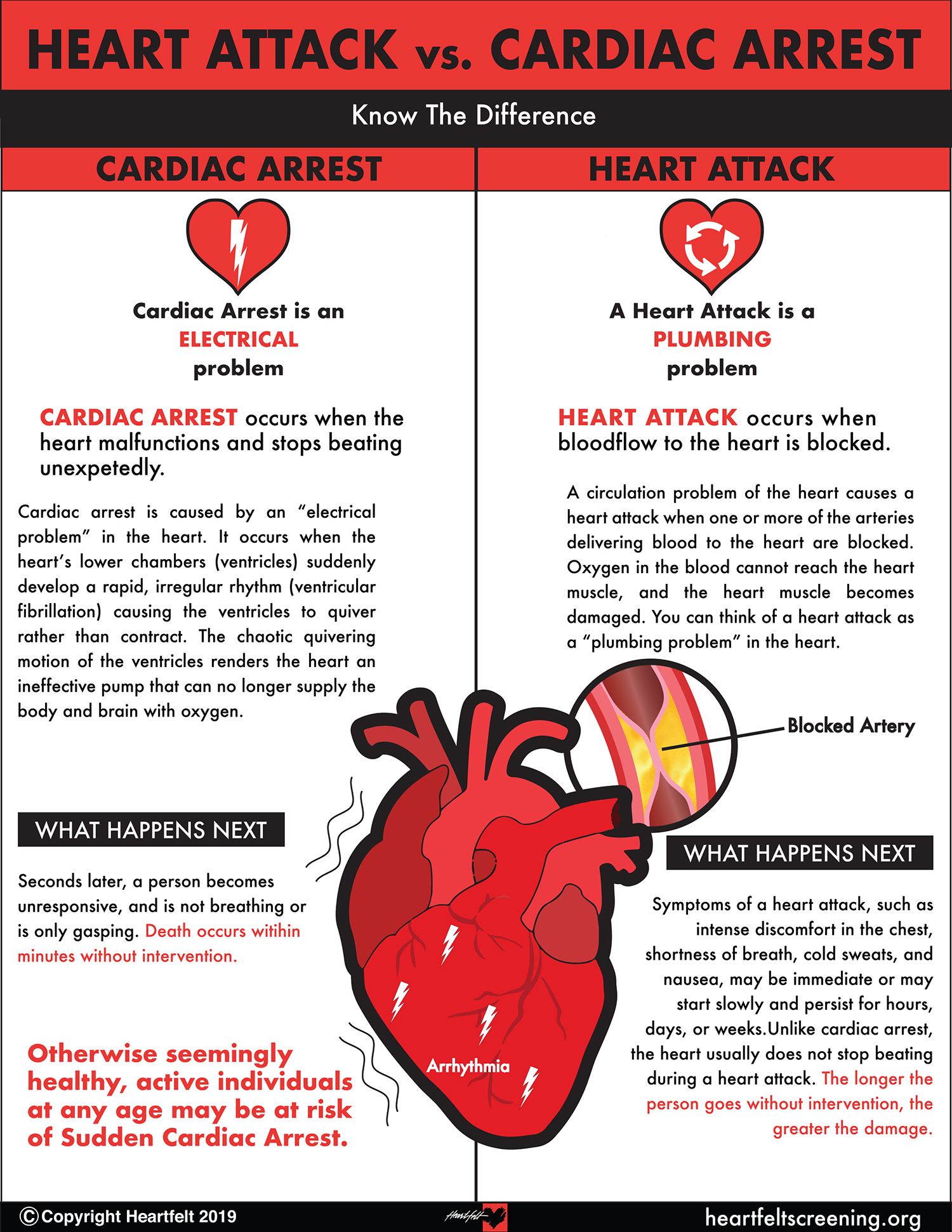 Sudden Cardiac Arrest (SCA) - Heartfelt